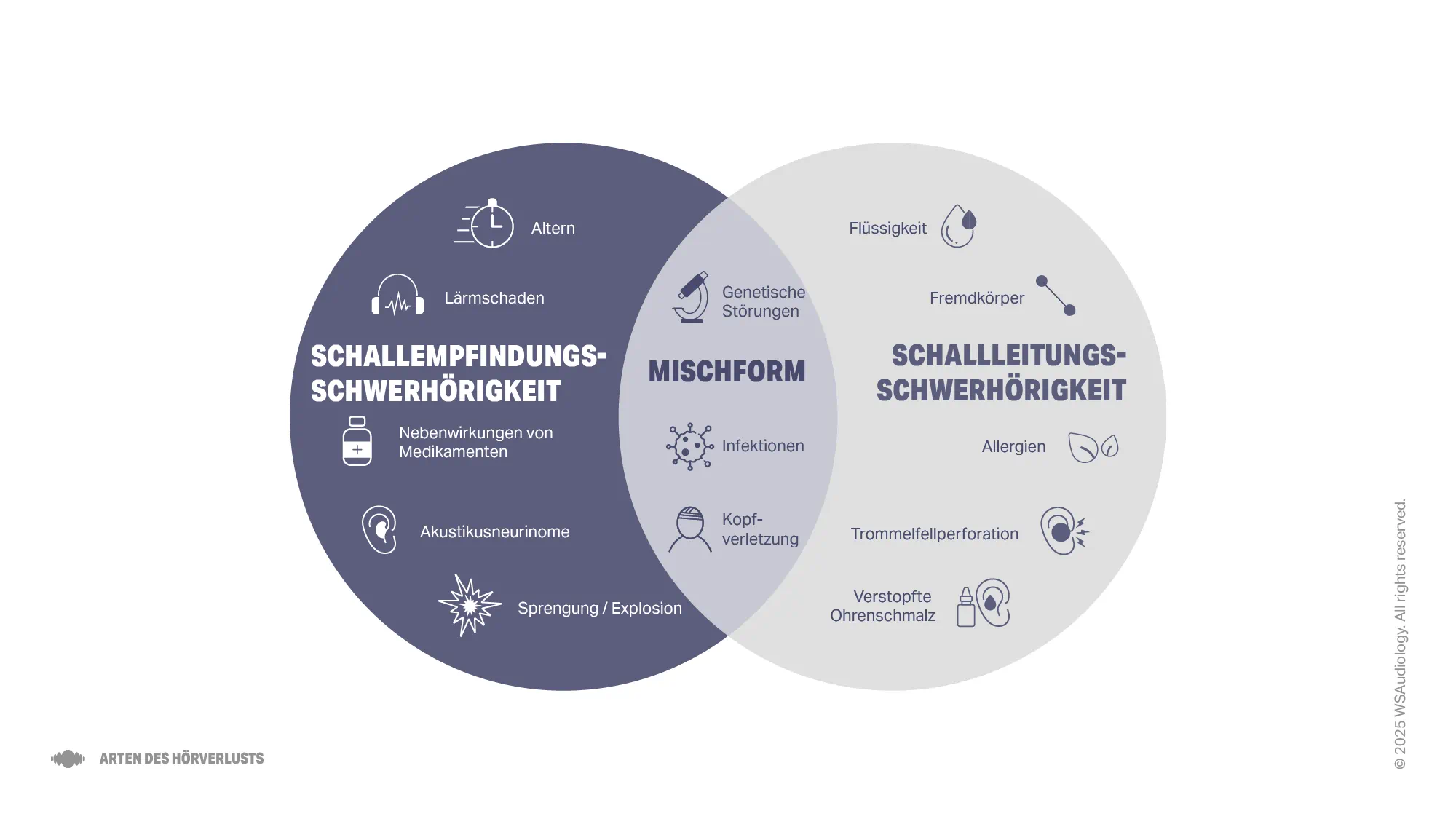 Illustration zum Vergleich von sensorineuralem, leitungsbedingtem und kombiniertem Hörverlust, mit Hervorhebung der Ursachen für jeden Teil.