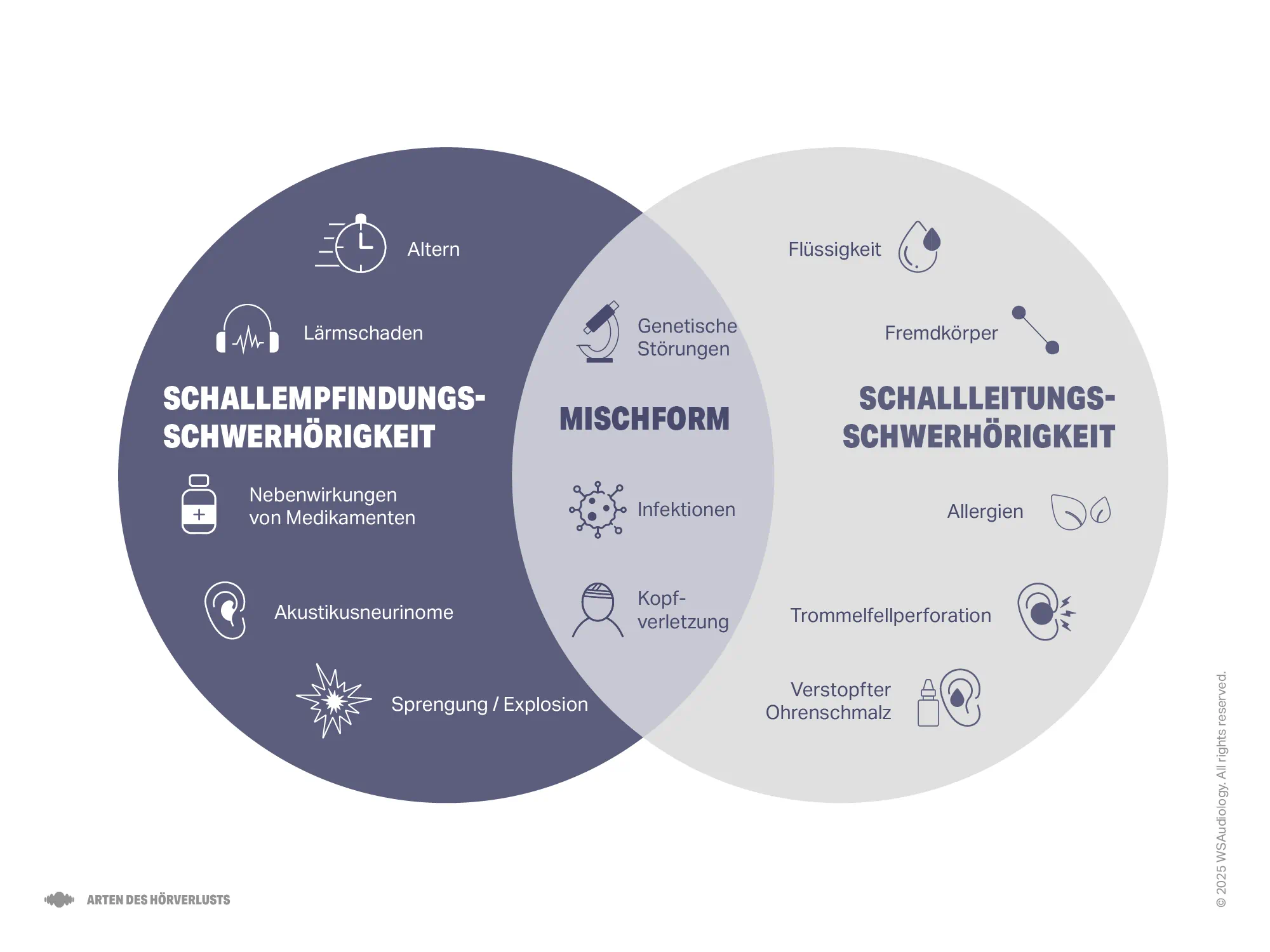 Illustration zum Vergleich von sensorineuralem, leitungsbedingtem und kombiniertem Hörverlust, mit Hervorhebung der Ursachen für jeden Teil.