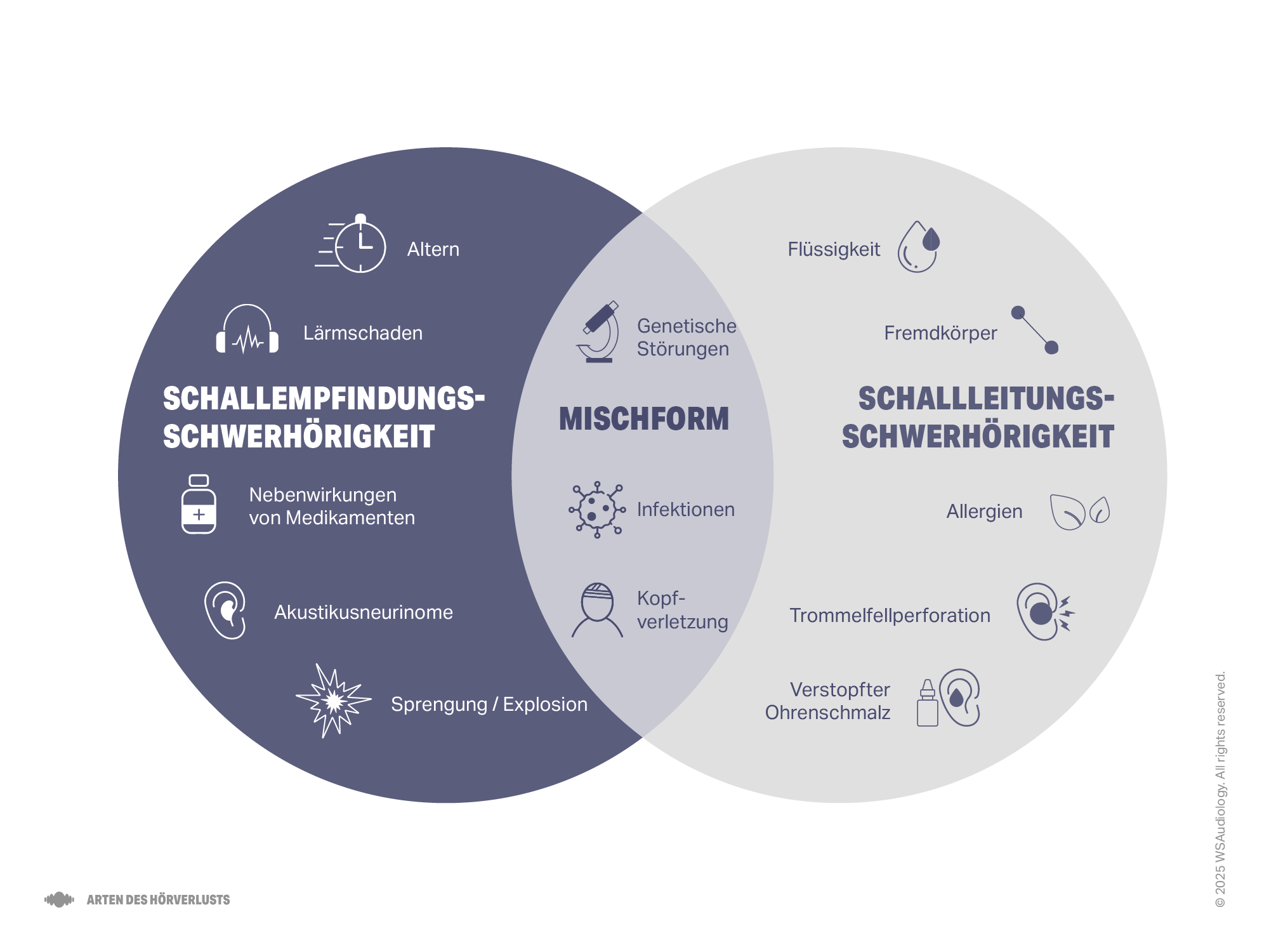 Illustration zum Vergleich von sensorineuralem, leitungsbedingtem und kombiniertem Hörverlust, mit Hervorhebung der Ursachen für jeden Teil.