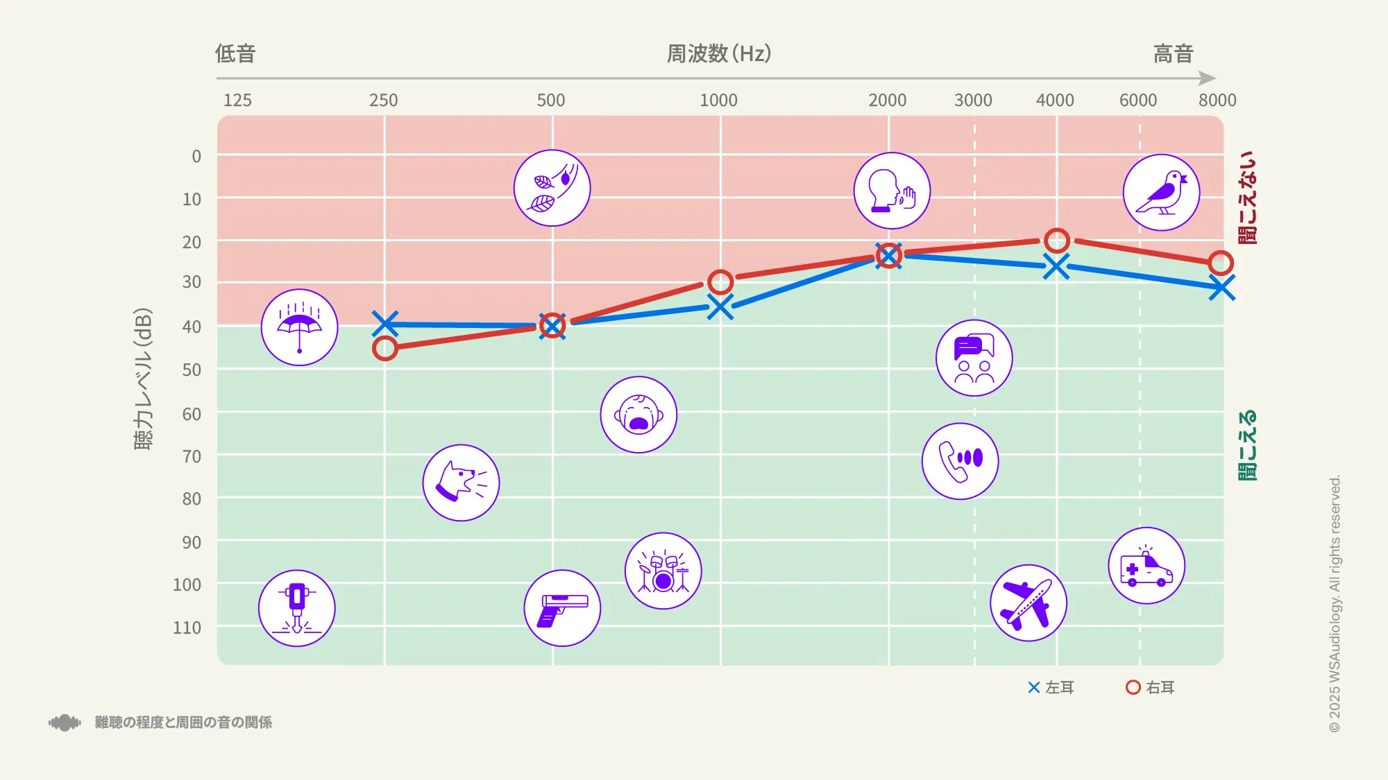 外耳または中耳での音の伝達に問題がある伝音性難聴を示すオージオグラム。