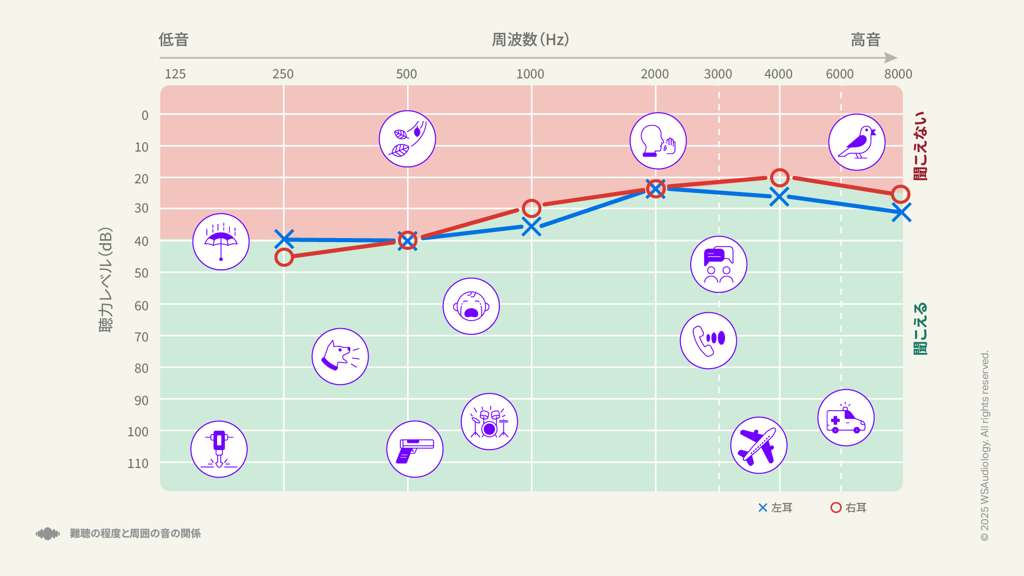 外耳または中耳での音の伝達に問題がある伝音性難聴を示すオージオグラム。
