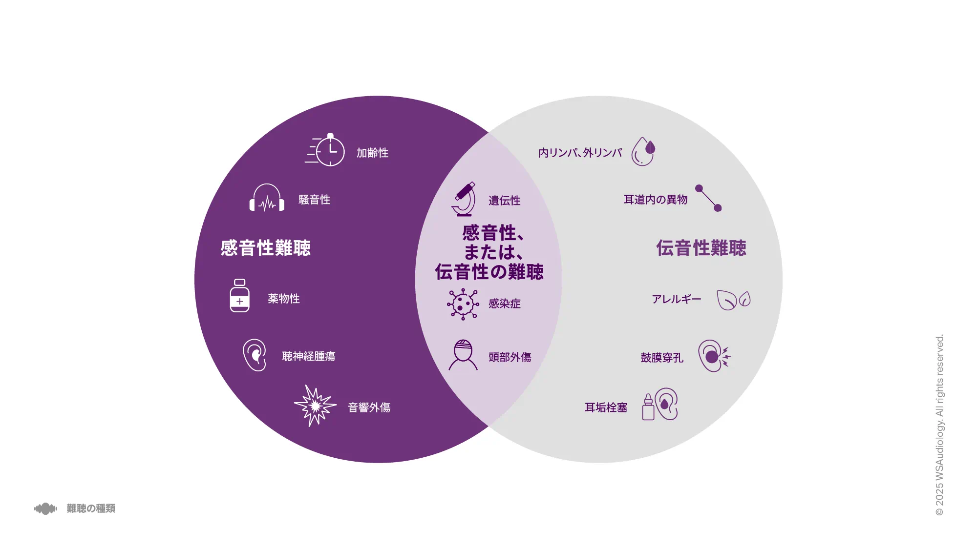 感音性、伝音性、混合性難聴を比較し、それぞれの原因を示すイラスト。