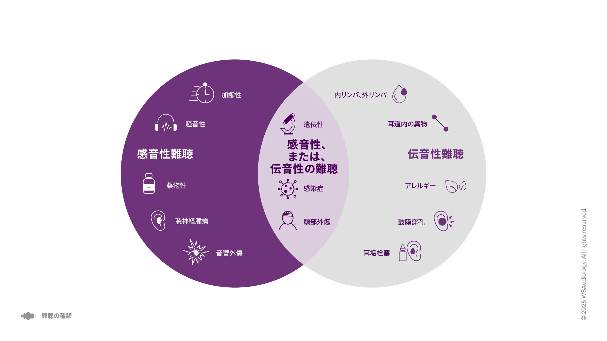 感音性、伝音性、混合性難聴を比較し、それぞれの原因を示すイラスト。
