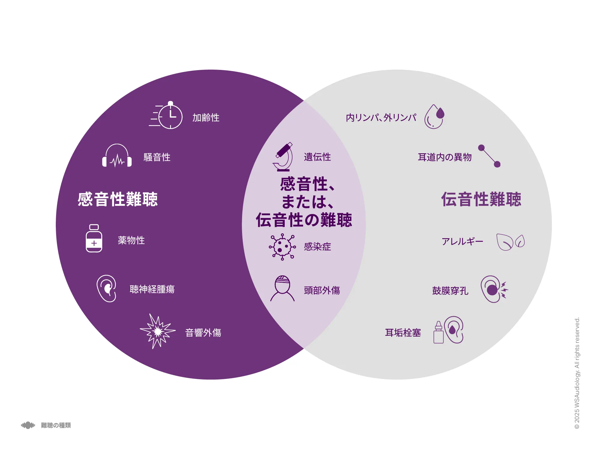感音性、伝音性、混合性難聴を比較し、それぞれの原因を示すイラスト。