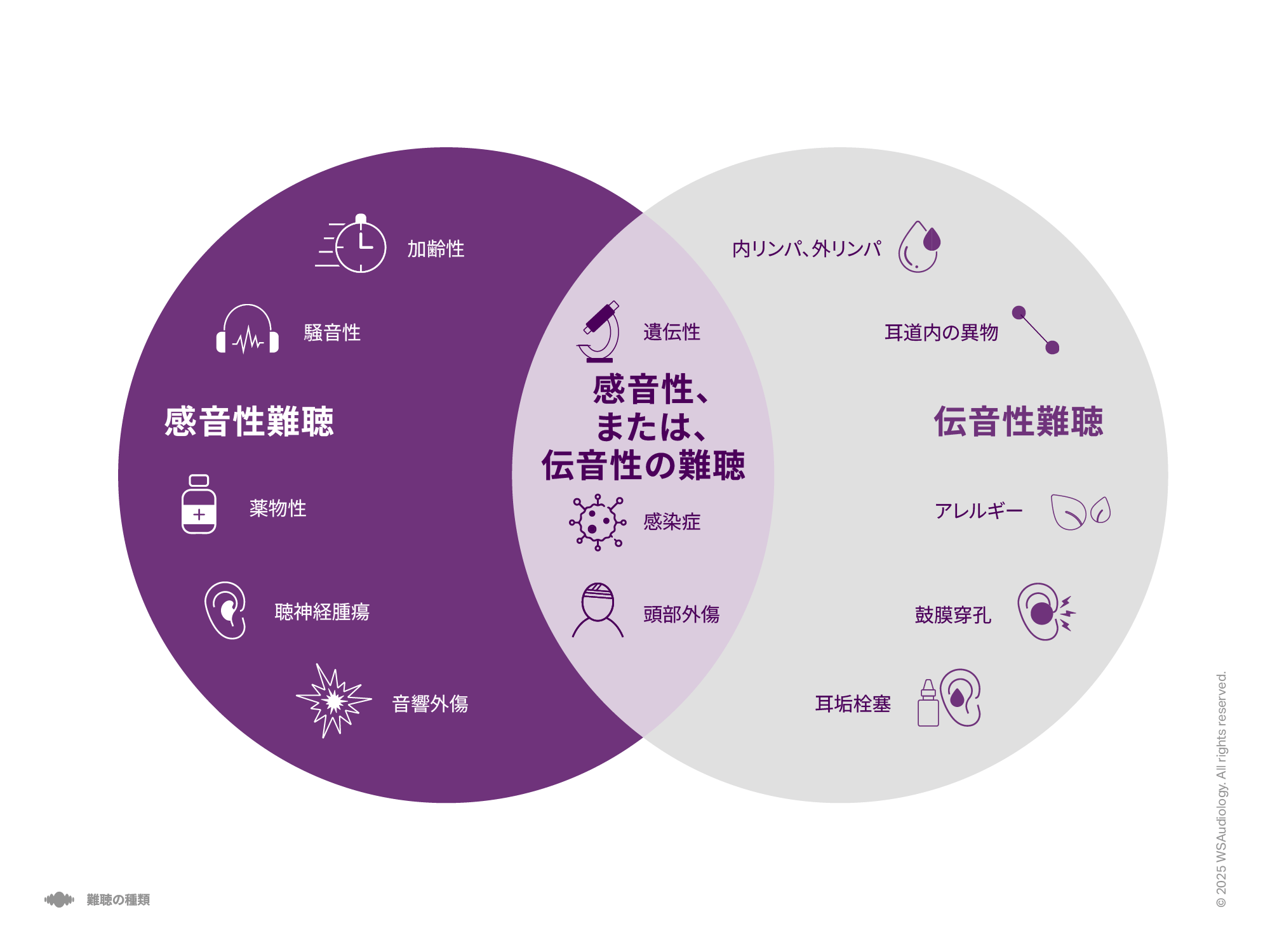 感音性、伝音性、混合性難聴を比較し、それぞれの原因を示すイラスト。