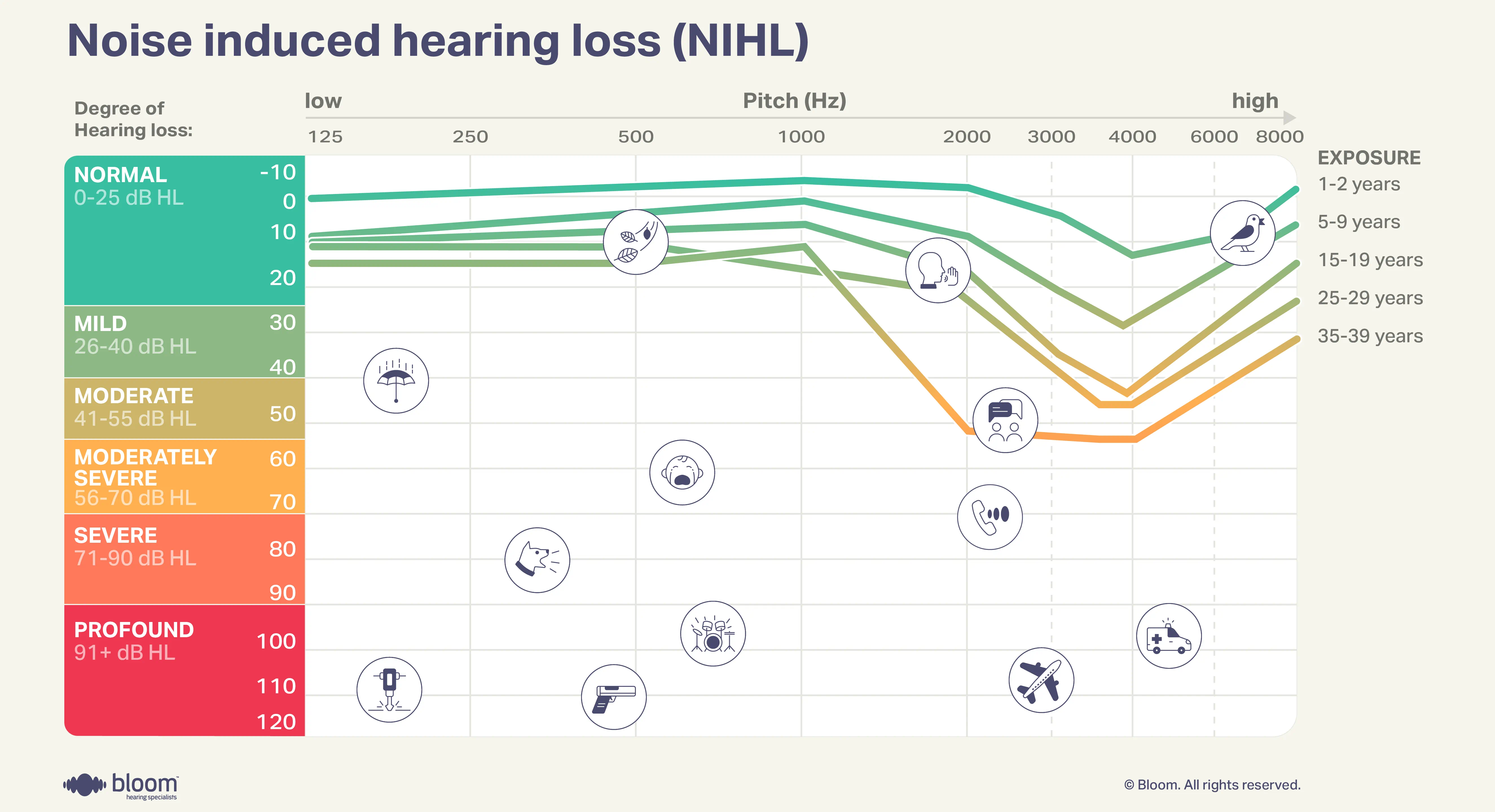 Audiogram illustrating hearing loss caused by exposure to loud noise.