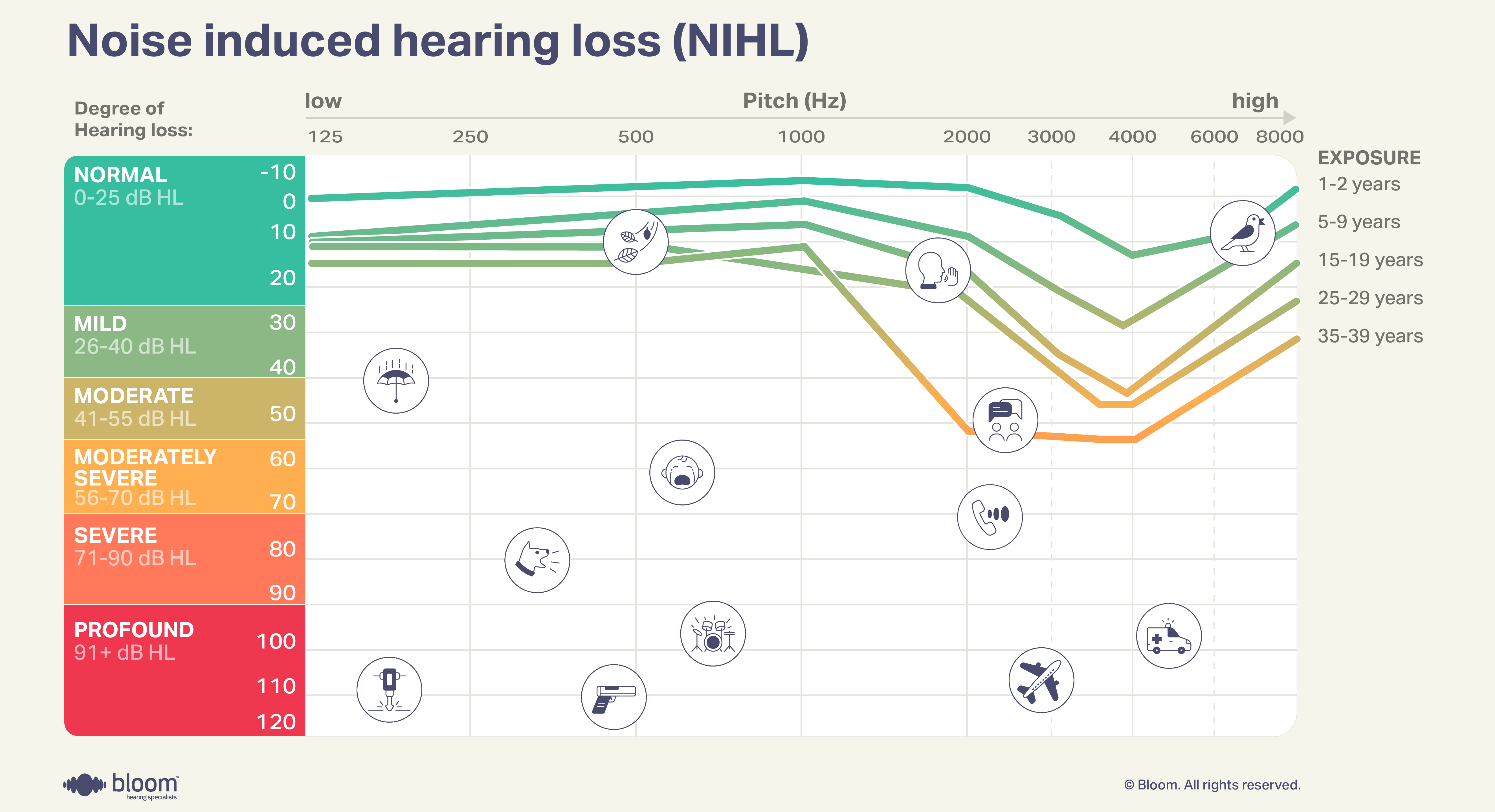 Audiogram illustrating hearing loss caused by exposure to loud noise.