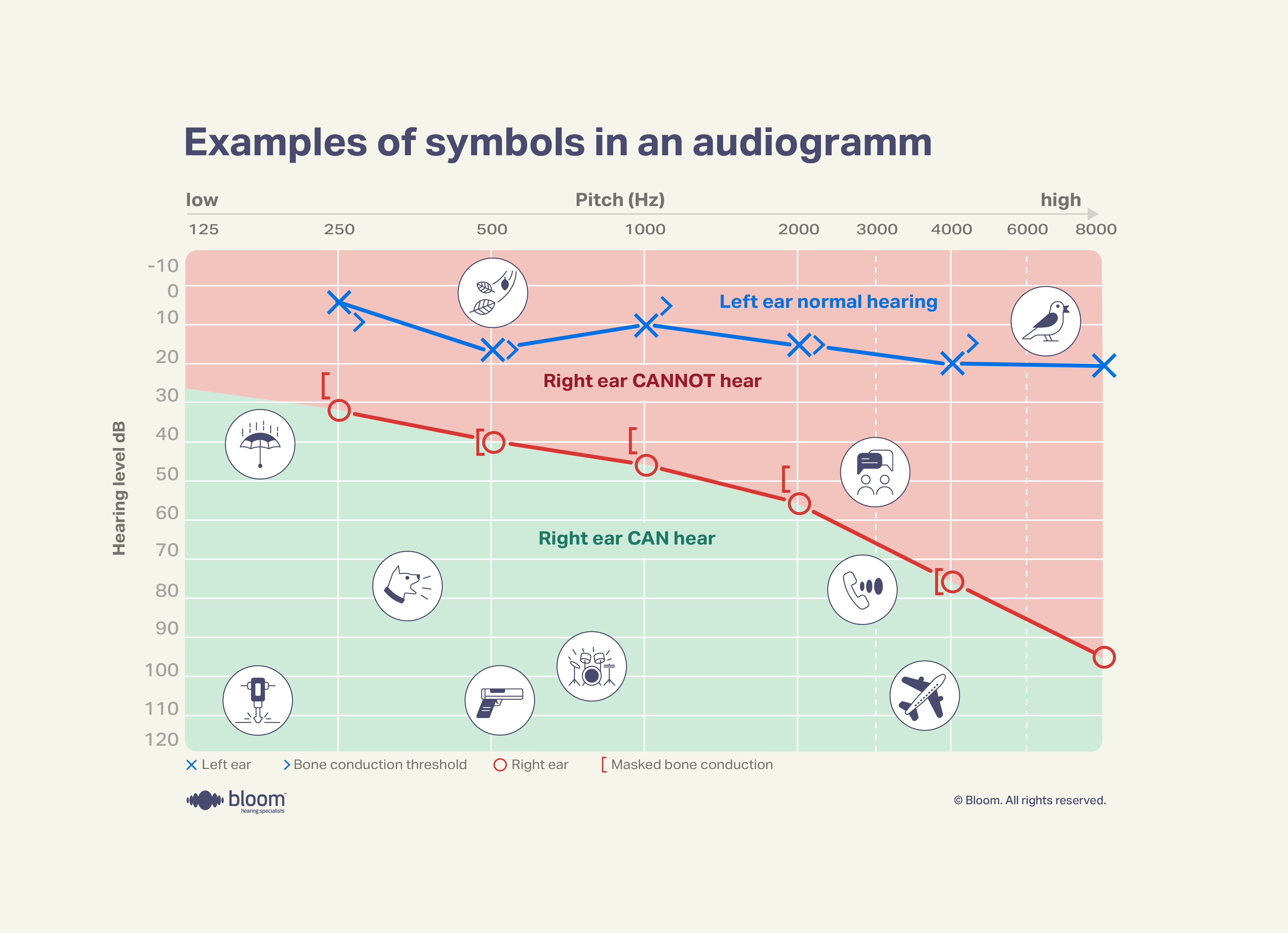 Illustration showing common symbols used on audiograms for hearing tests.