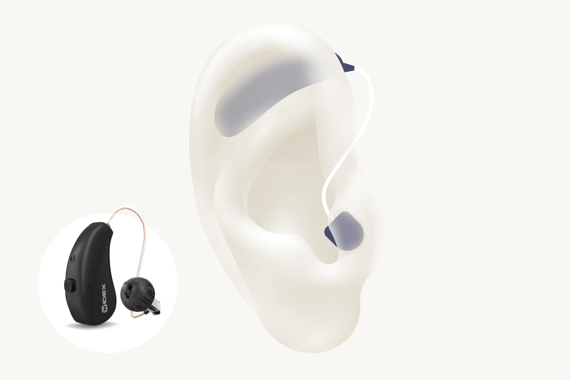 Illustration showing the types of hearing aid called RIC which is worn with the receiver in the ear canal with Widex Moment sRIC RD.