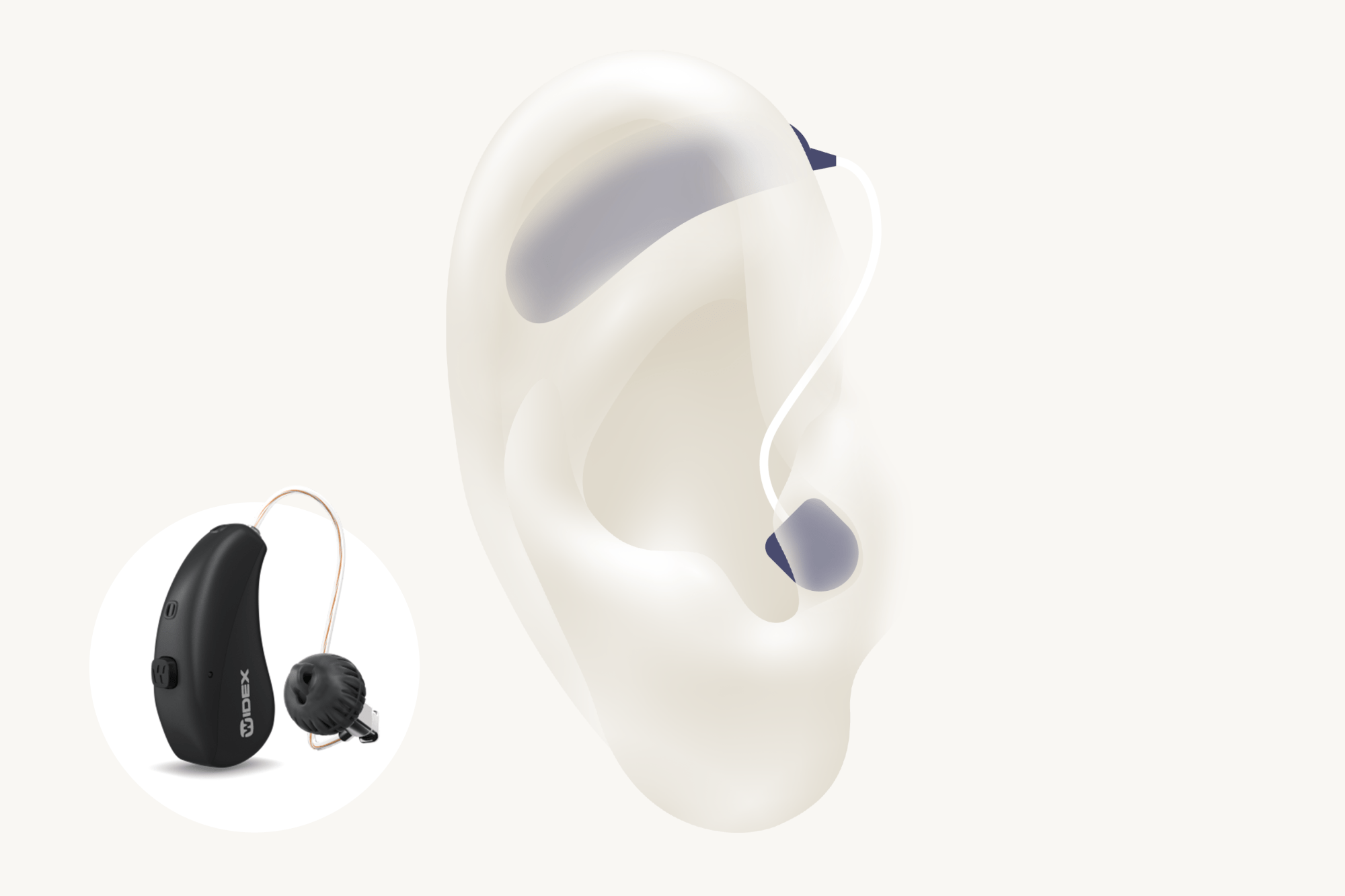 Illustration showing the types of hearing aid called RIC which is worn with the receiver in the ear canal with Widex Moment sRIC RD.