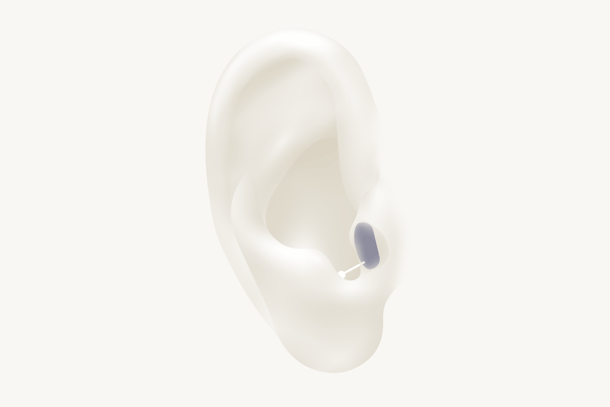 Gif with ear showing all types of hearing aids such as BTE, ITE, CIC, IIC, RIC