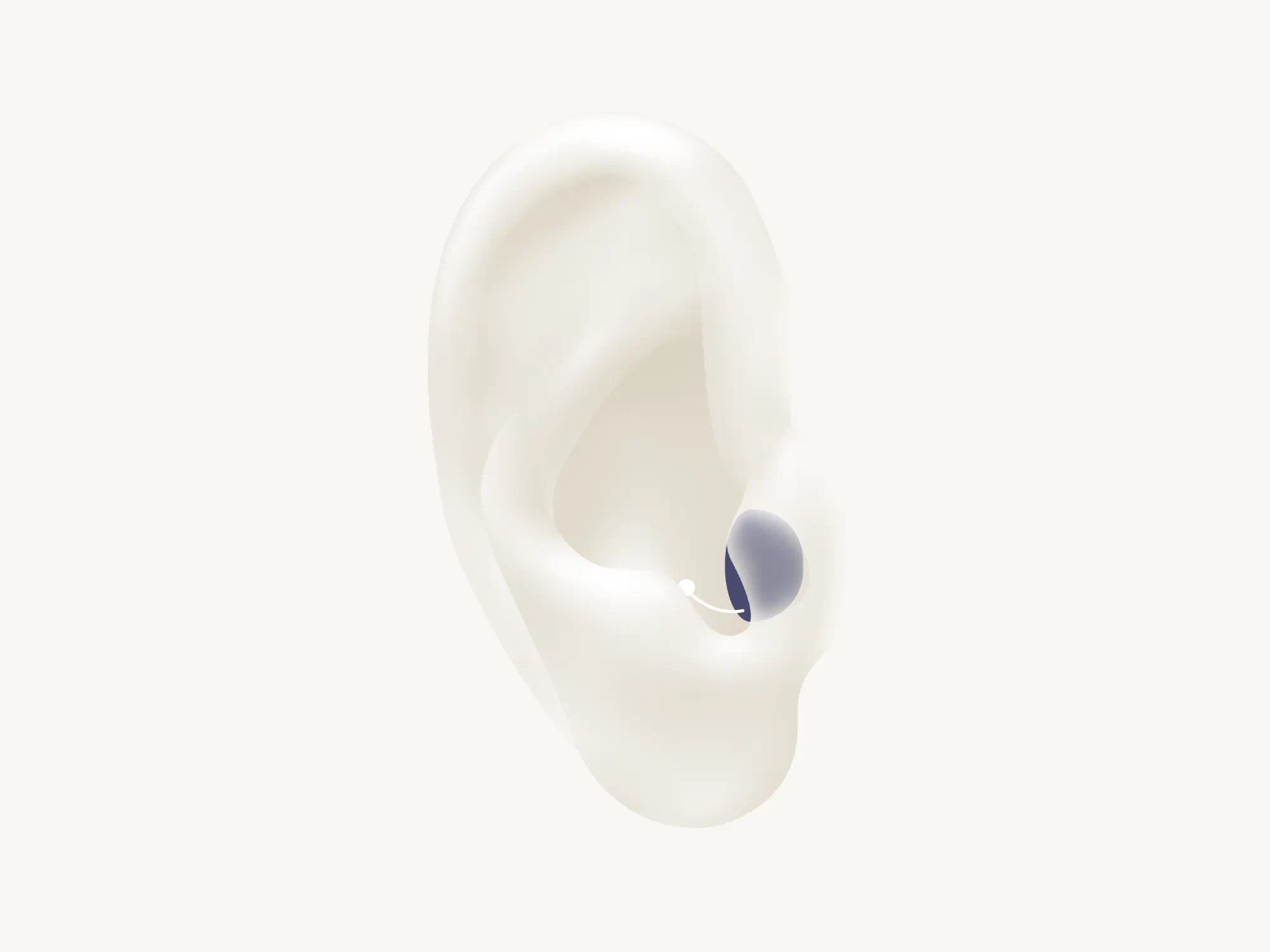 Illustration showing the types of hearing aid called CIC which is worn completely in the ear.