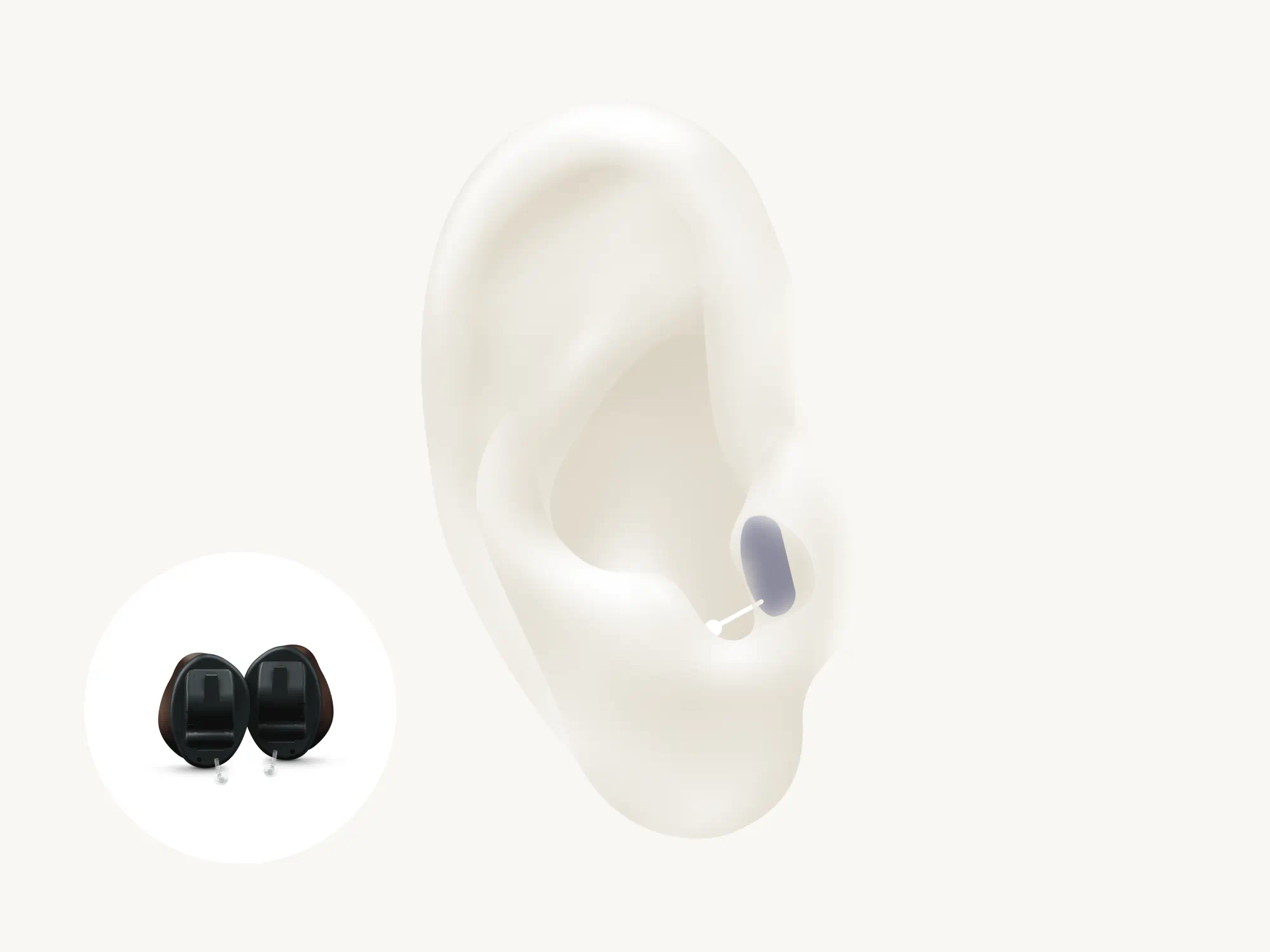 In-the-canal (ITC) hearing aid