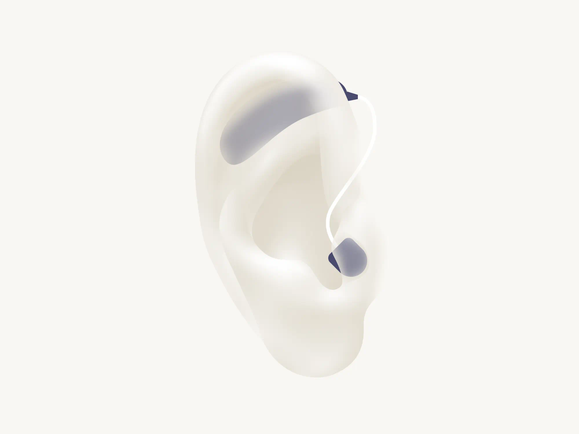 Illustration showing the types of hearing aid called RIC which is worn with the receiver in the ear canal.