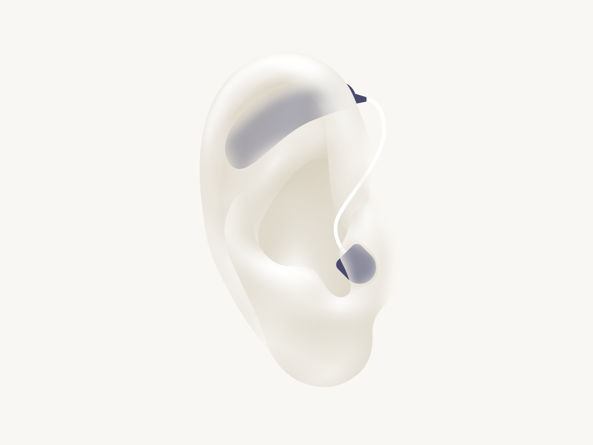 Illustration showing the types of hearing aid called RIC which is worn with the receiver in the ear canal.