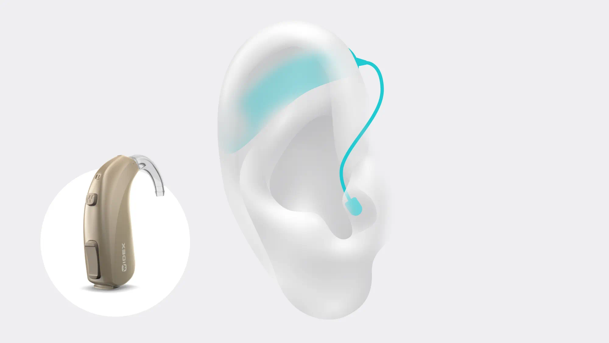 Widex Allure BTE R D illustrated comfortably sitting behind the ear