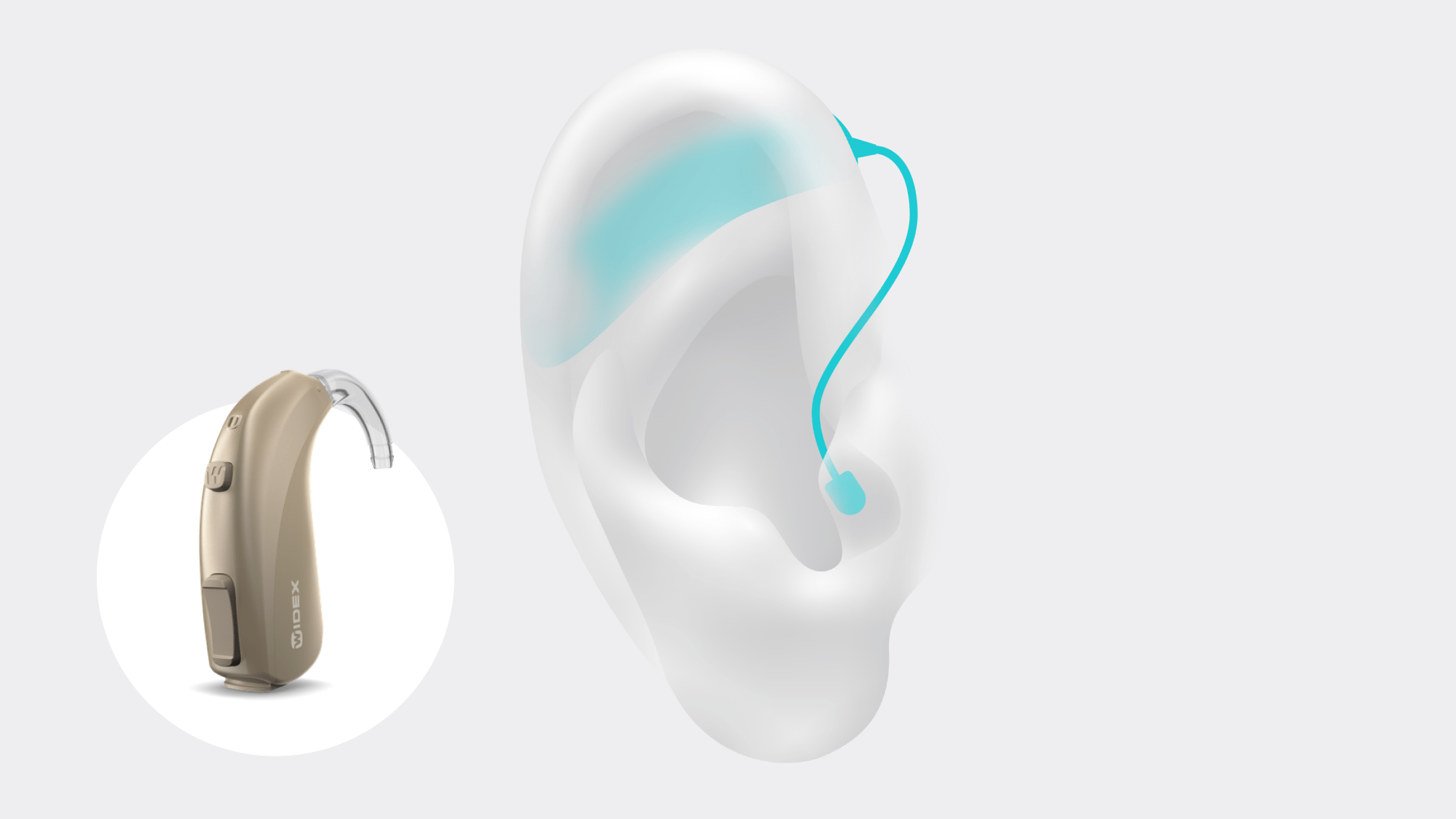 Widex Allure BTE R D illustrated comfortably sitting behind the ear