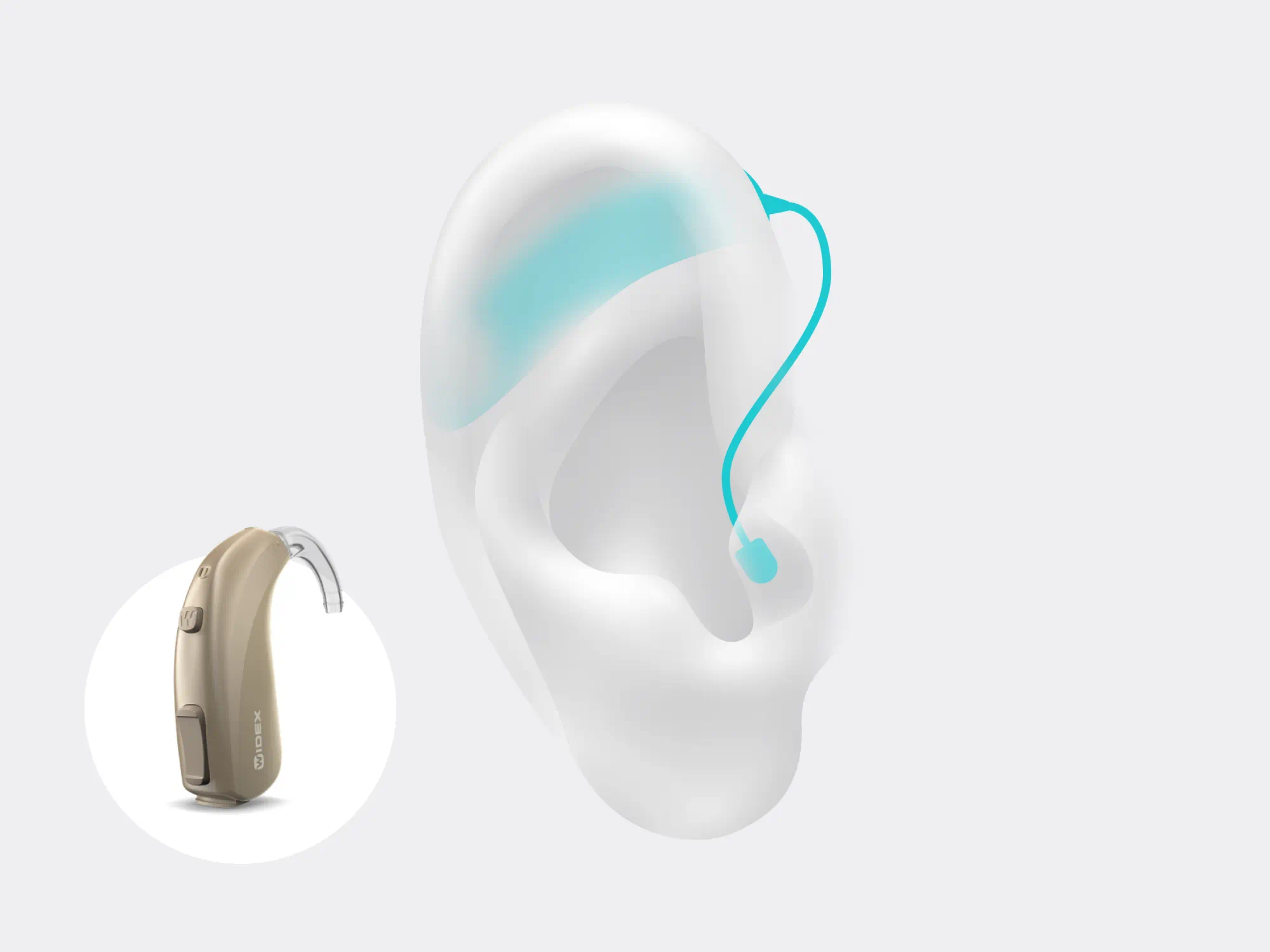 Illustration showing the types of hearing aid called bte which is worn behind the ear with Signia Pure Charge&Go Nx in sandy-brown