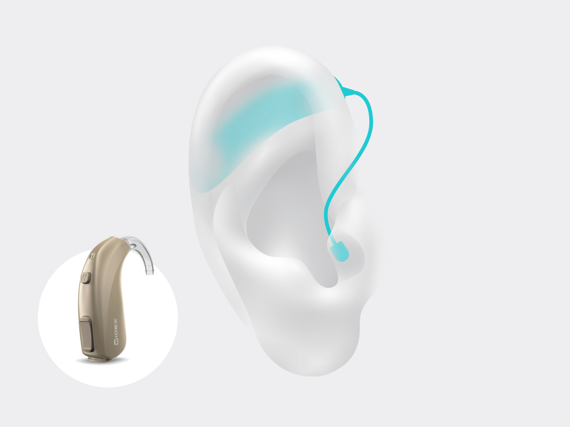 Illustration showing the types of hearing aid called bte which is worn behind the ear with Signia Pure Charge&Go Nx in sandy-brown