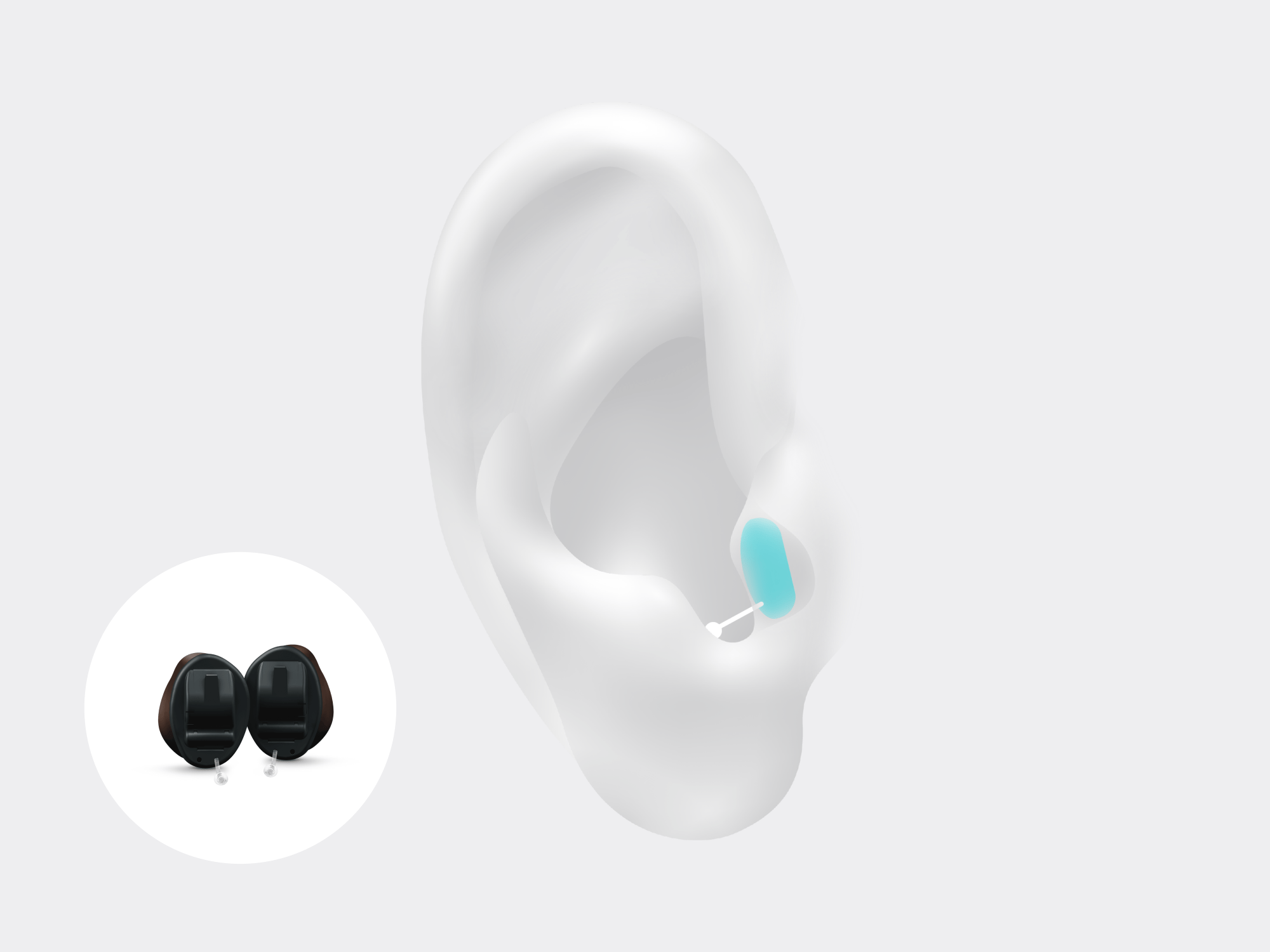 Illustration showing the types of hearing aid called IIC which is worn in the ear canal also called invisible in canal hearing aid with Signia Insio Nx.