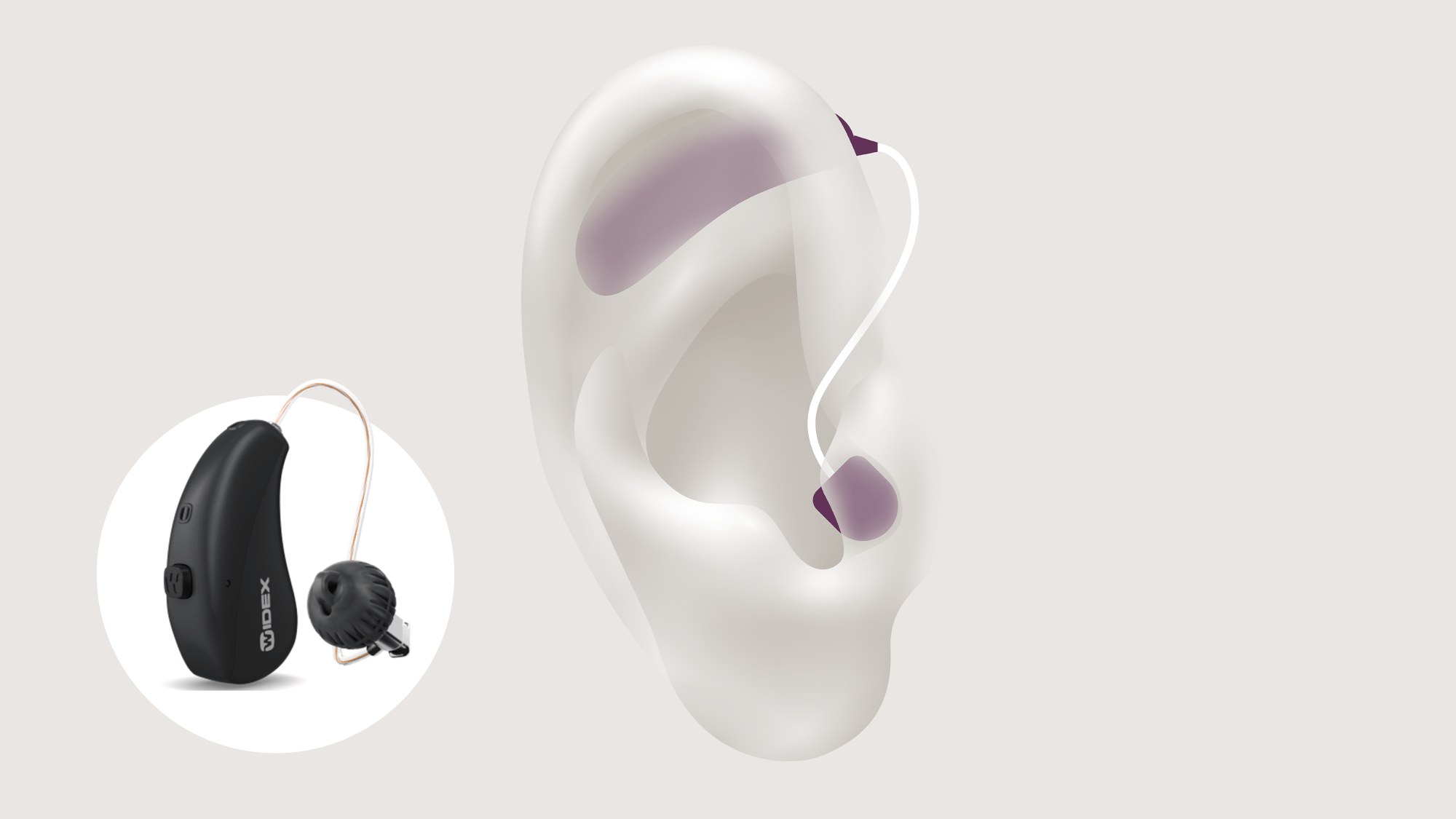 types of hearing-aids-ric-w-widex-sric-rd-16x9