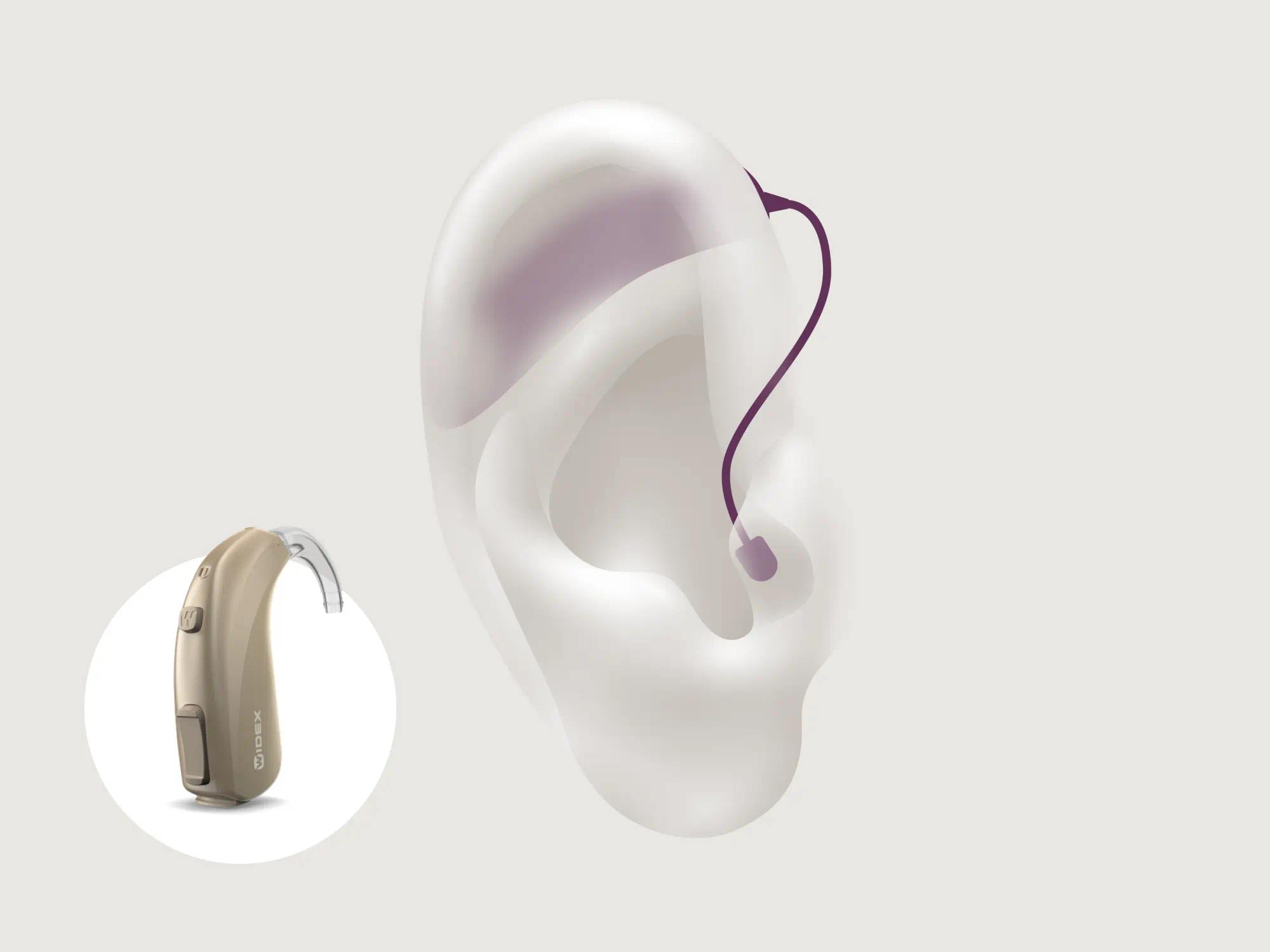 Illustration showing the types of hearing aid called bte which is worn behind the ear with Signia Pure Charge&Go Nx in sandy-brown