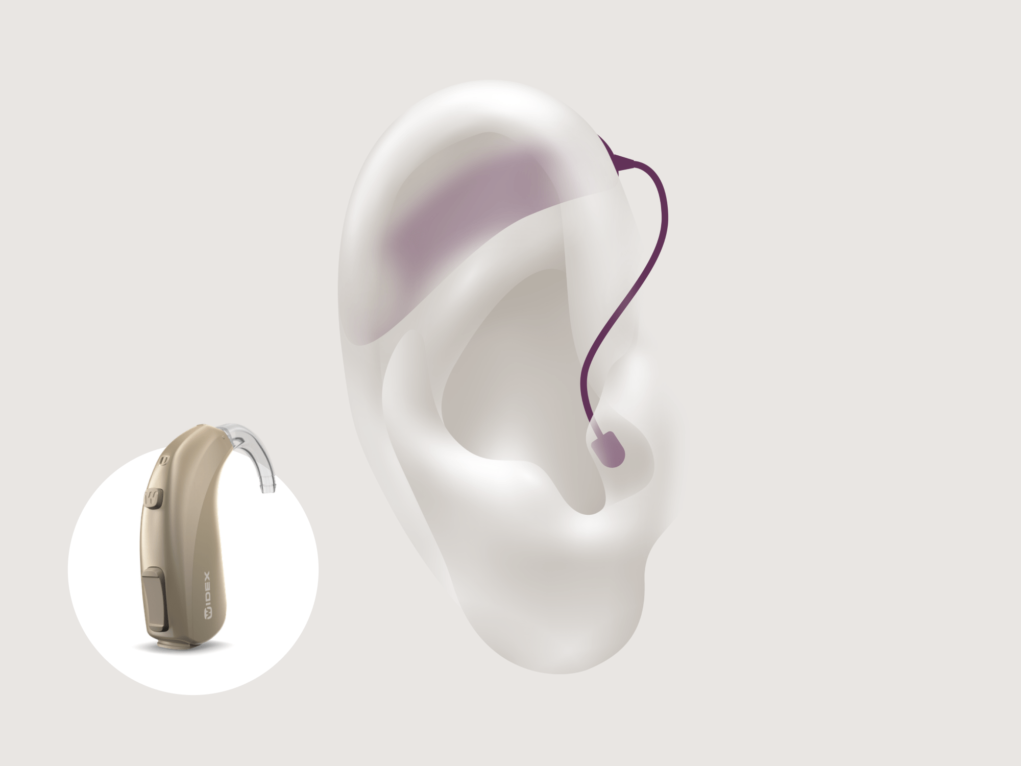 types of hearing-aids-bte-signia-pure-cng-nx-4x3