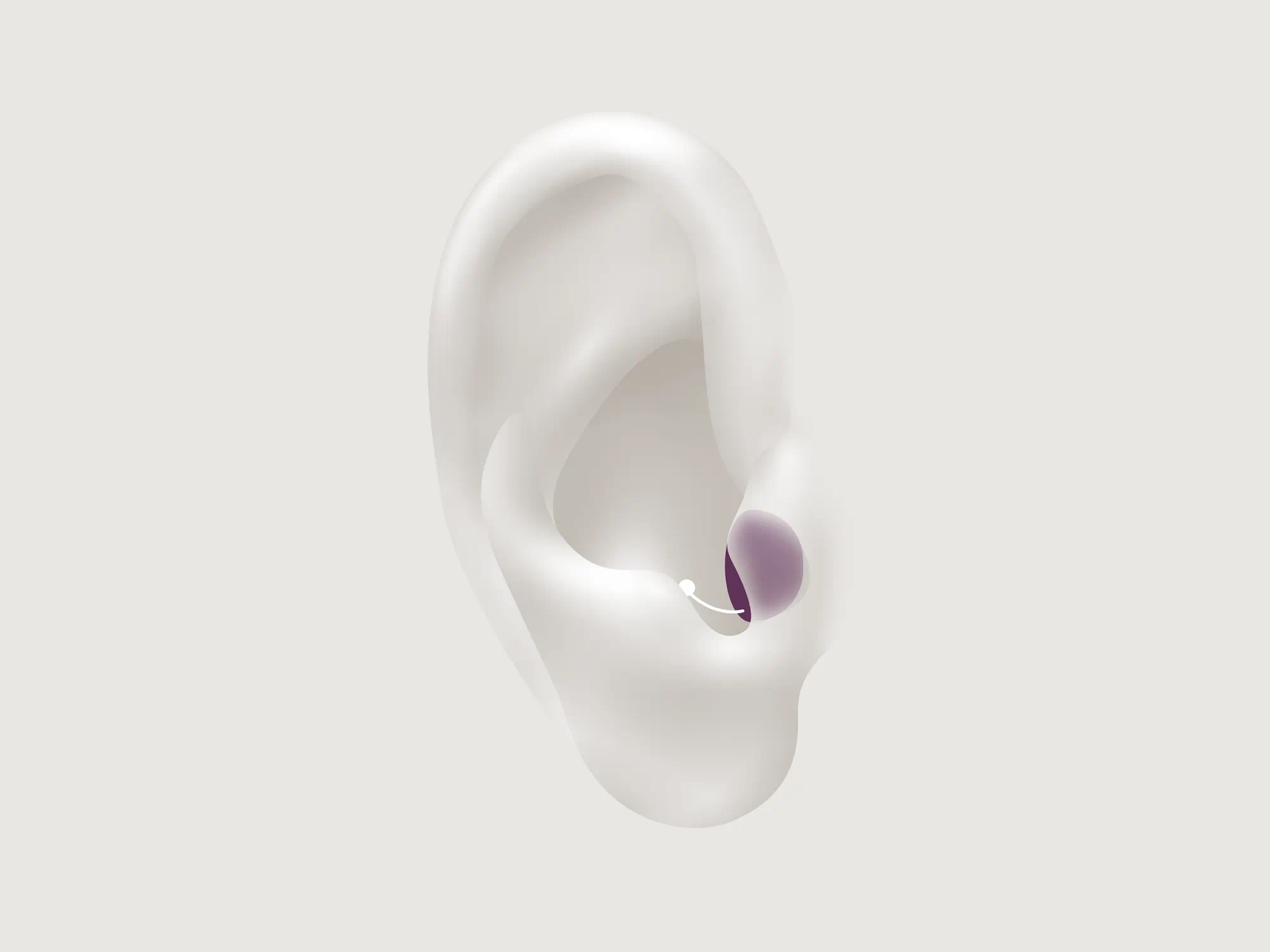 Illustration showing the types of hearing aid called CIC which is worn completely in the ear.