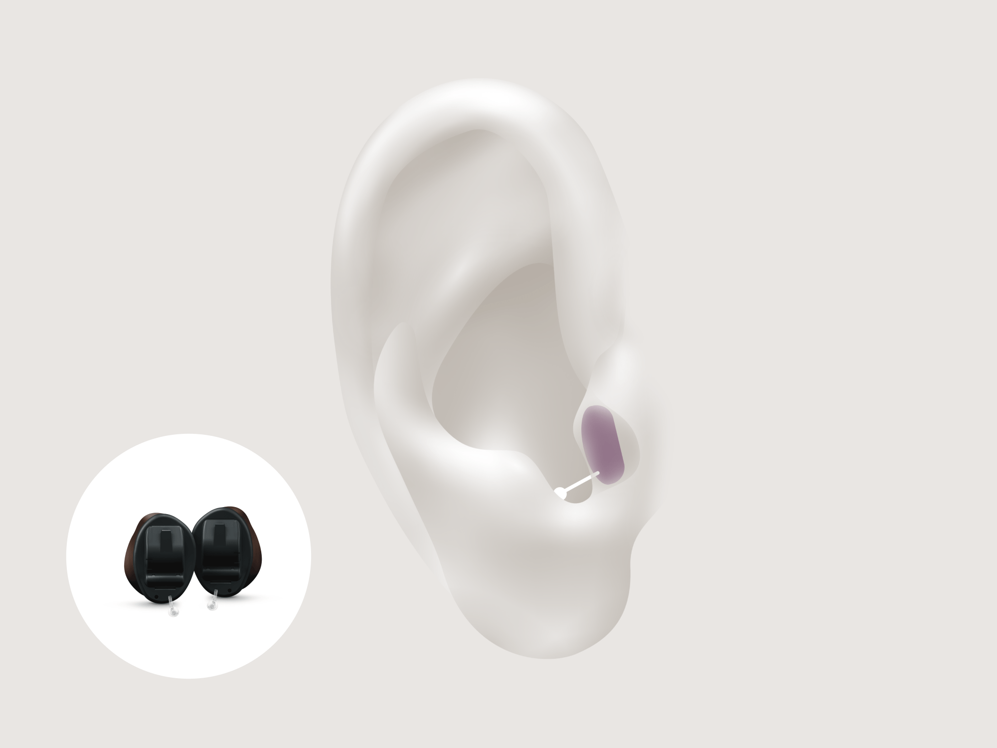 types of hearing-aids-iic-w-signia-insio-nx-4x3