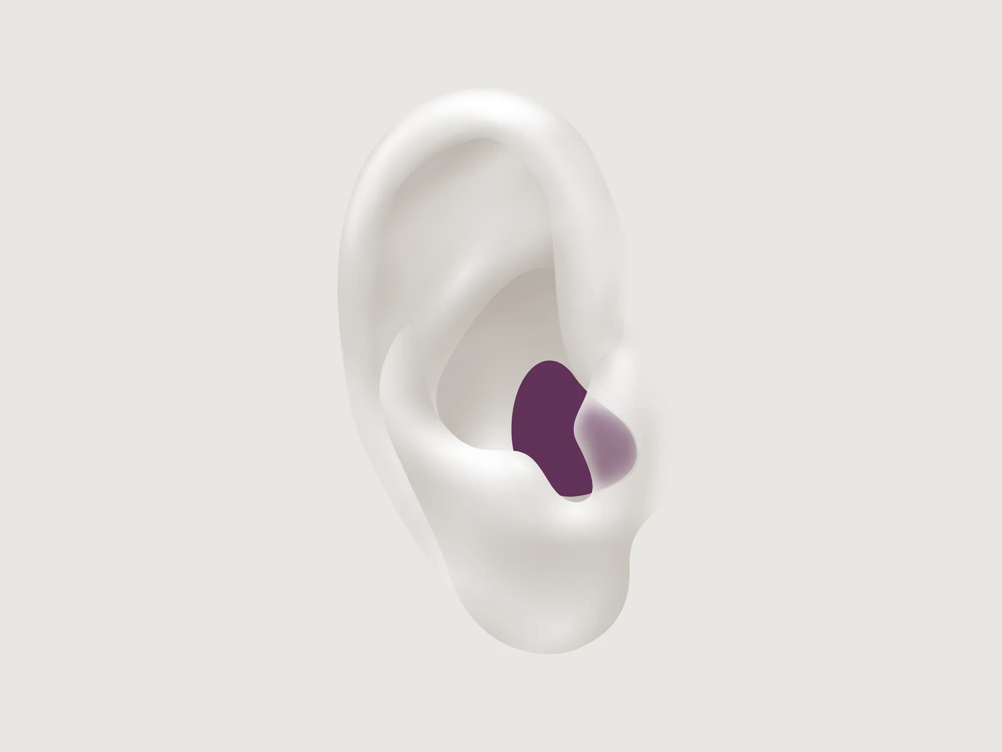 Illustration showing the types of hearing aid called ITE which is worn in the canal.