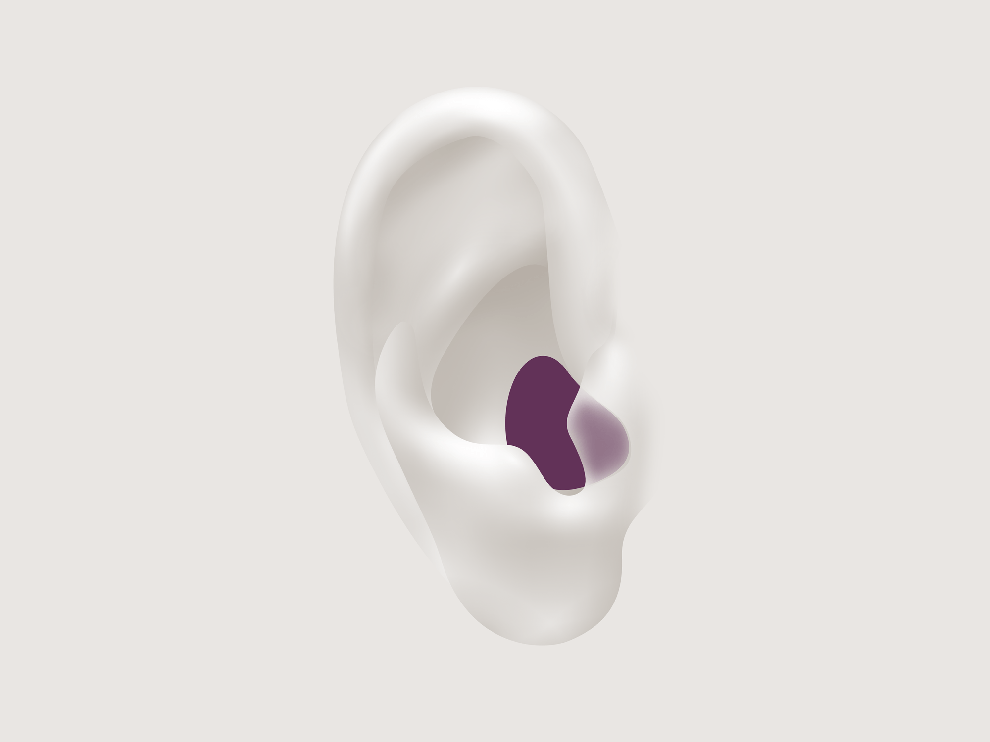 Illustration showing the types of hearing aid called ITE which is worn in the canal.