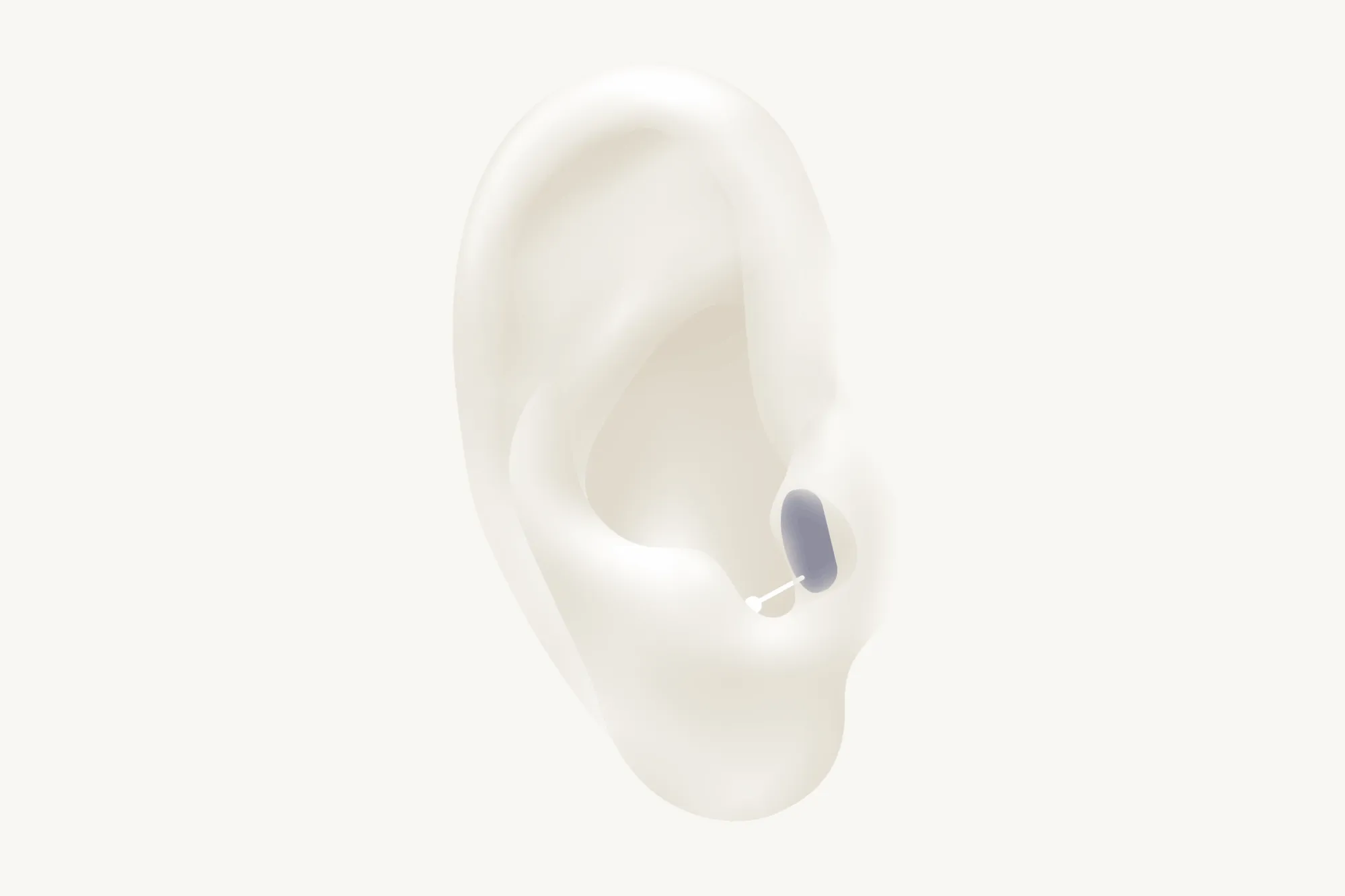 Gif with ear showing all types of hearing aids such as BTE, ITE, CIC, IIC, RIC