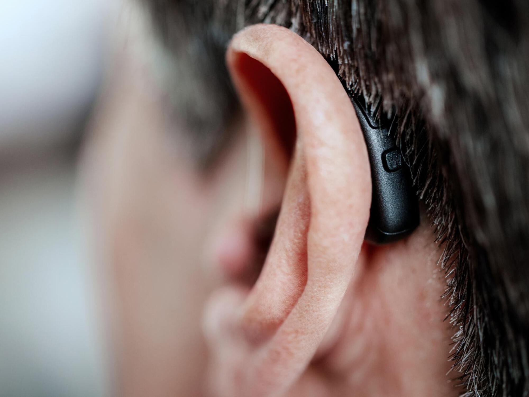Aparelho Auditivo Widex Allure AI RIC atrás da orelha