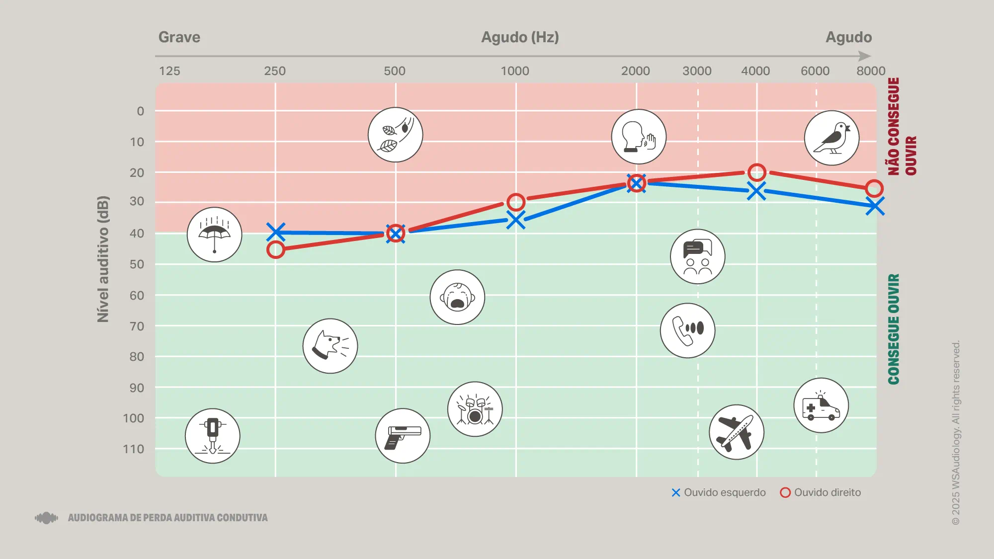conductive-hearing-loss-audiogram-16x9