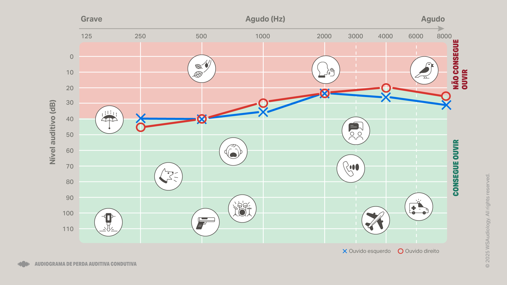 conductive-hearing-loss-audiogram-16x9
