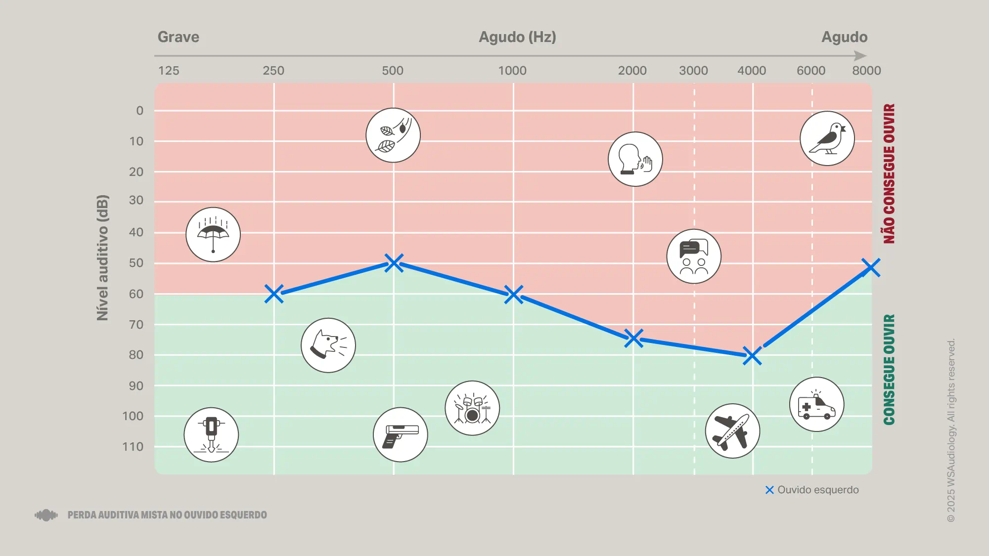 mixed-hearing-loss-audiogram-16x9