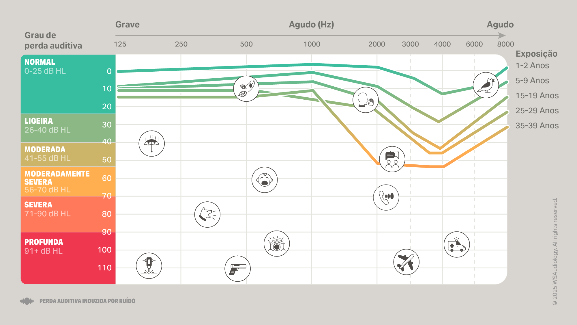 noise-induced-hearing-loss-audiogram-16x9