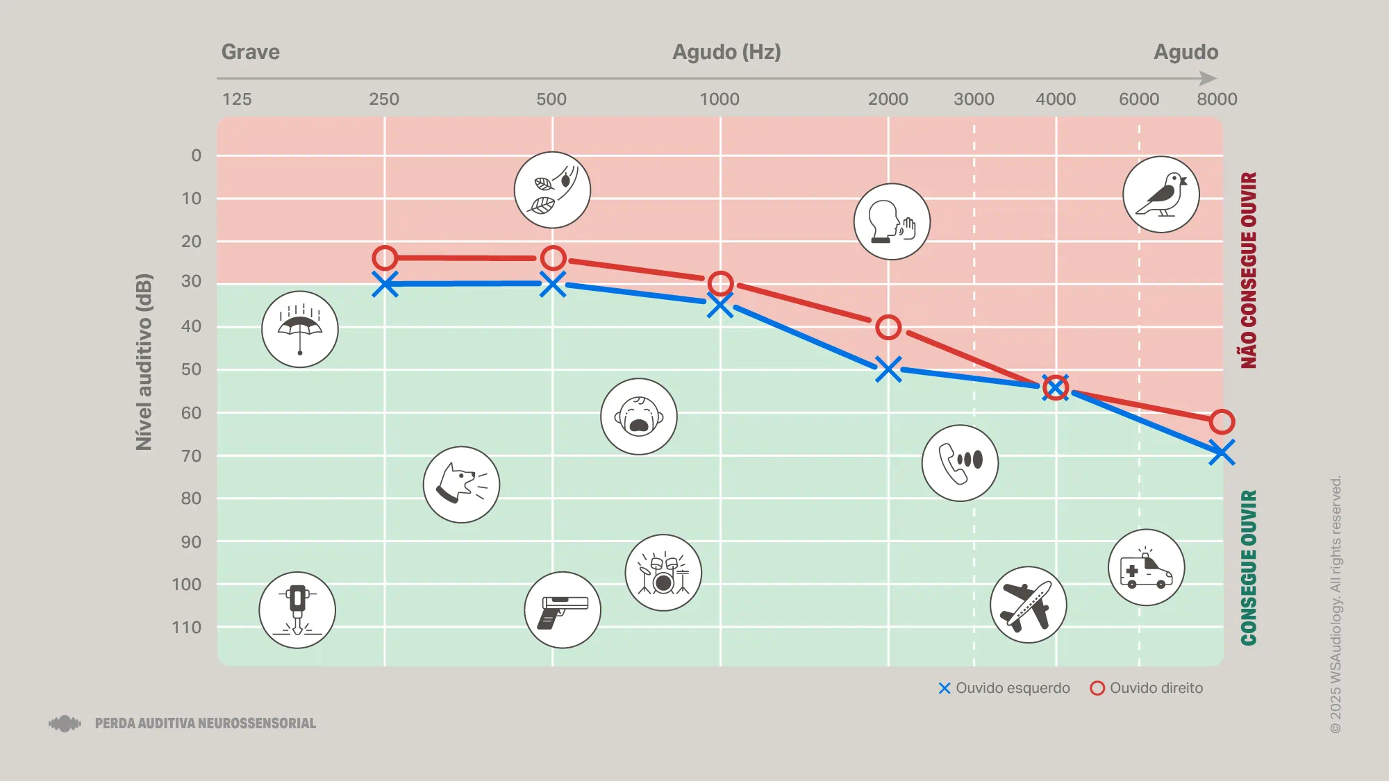 sensorineural-hearing-loss-audiogram-16x9