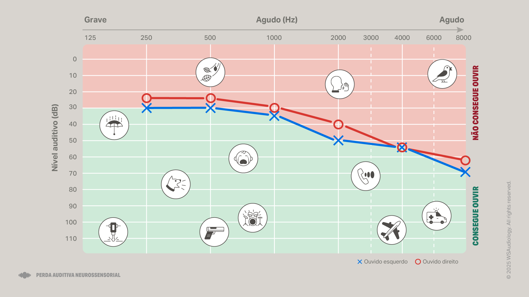 sensorineural-hearing-loss-audiogram-16x9