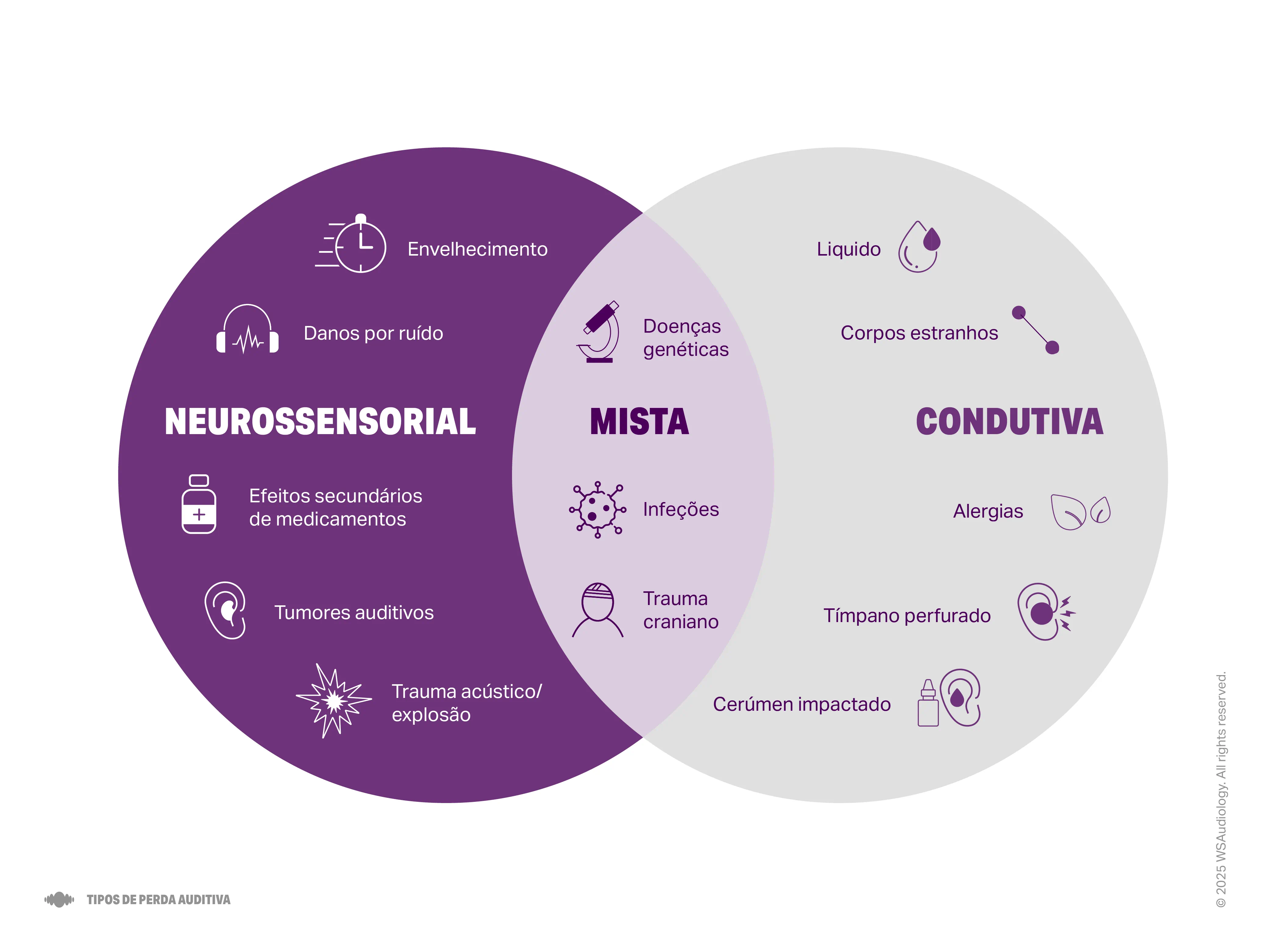 type-of-hearing-loss-4x3