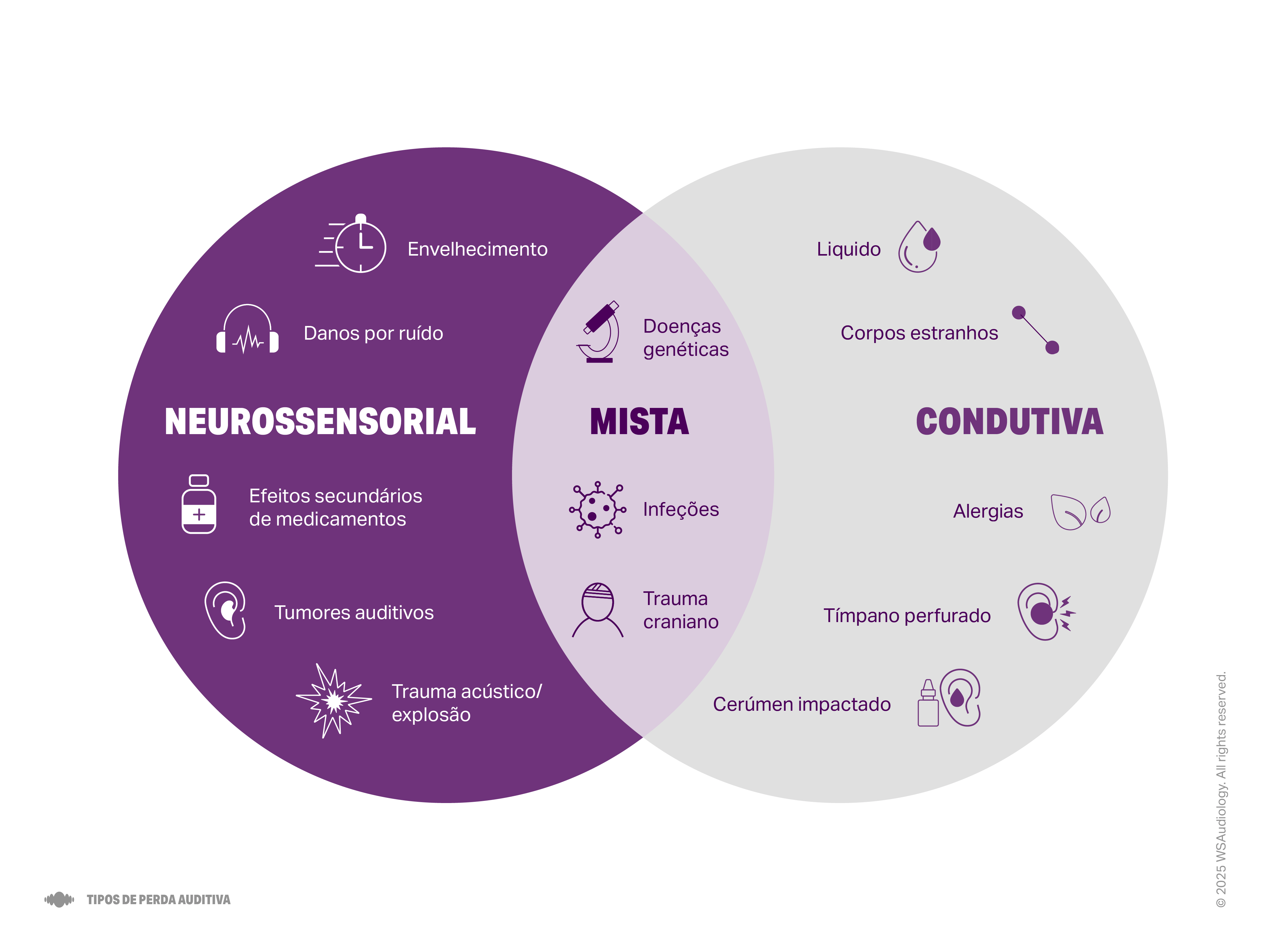 type-of-hearing-loss-4x3